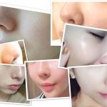毛穴から角栓がニョキっ!?皮膚科医で生まれた毛穴ケアなら、ここまで素肌がキレイになる♡!!